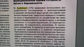 Структура миометрия изменена: что это значит в Ростелеком